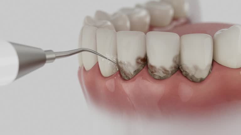Trusted Dental Implants service in Cleburne, TX - Dentist Open Now